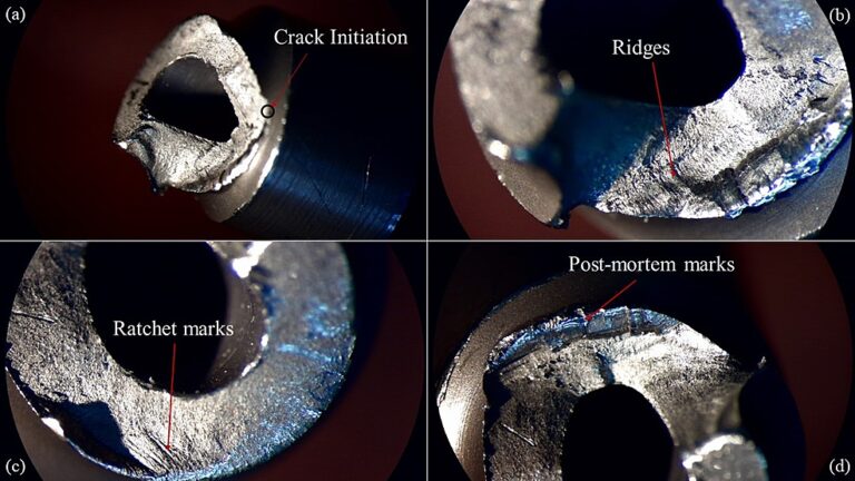 Forensics of Femoral Nail Failure
