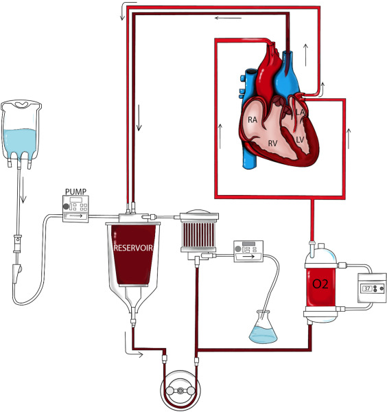 Schematic of an ex-vivo heart perfusion circuit with pump, reservoir, oxygenator and heart chamber