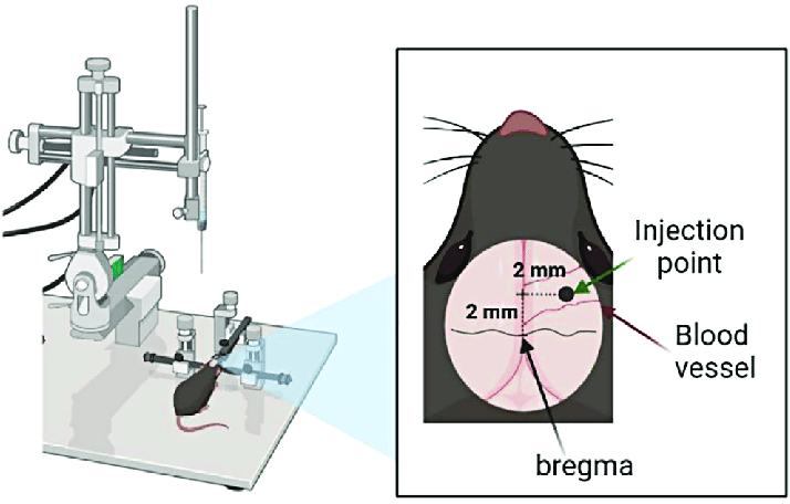 Traditional stereotaxic device and target-point reference diagram
