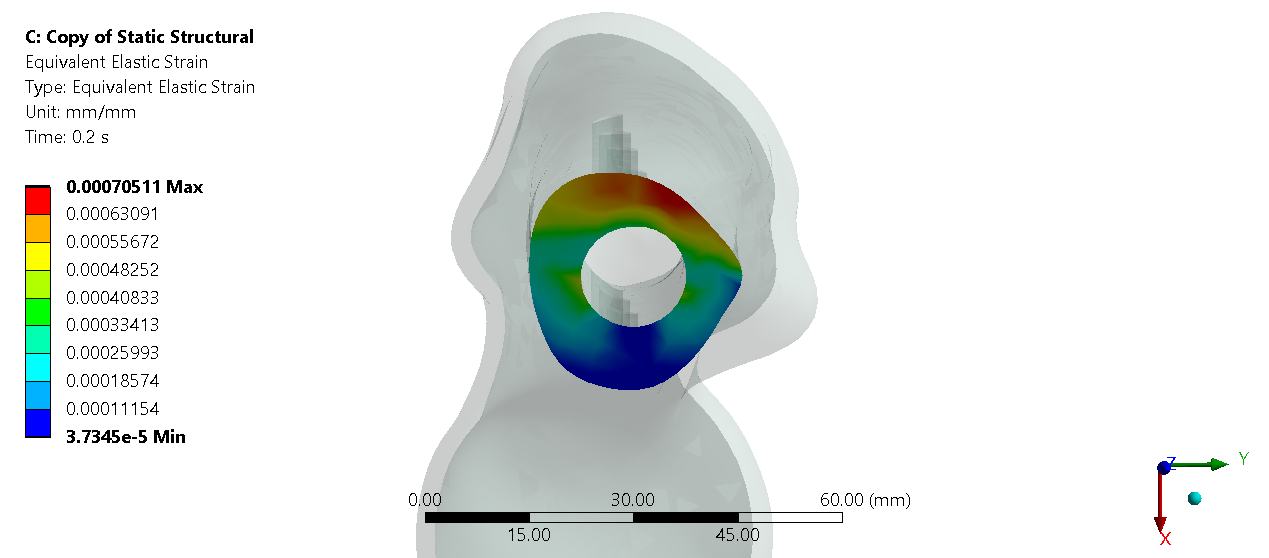 Rest-state fracture-area strain result for the A2 slot-hole plate design