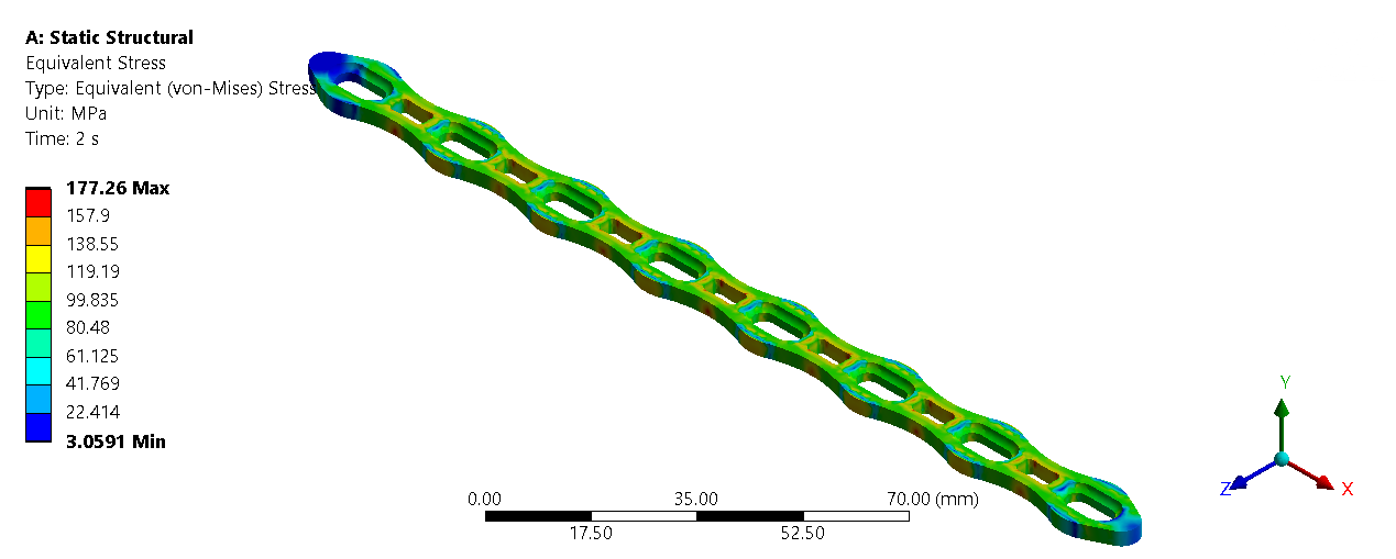 Finite element pretension stress result for the slot-hole superelastic compression plate